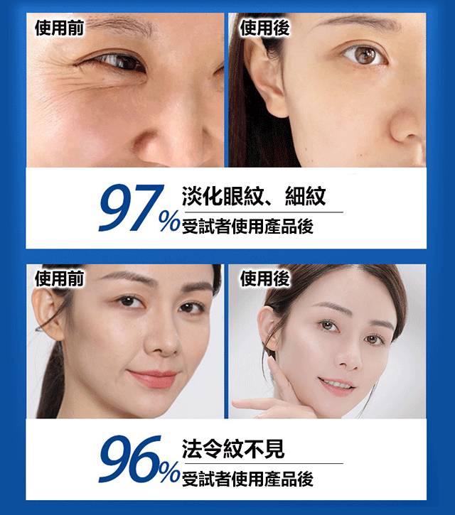 【日本技術】水光抗皺精華霜 28天消除皺紋 守護年輕水光抗皺精華霜 【日本技術】水光抗皺精華霜 28天消除皺紋 守護年輕水光抗皺精華霜